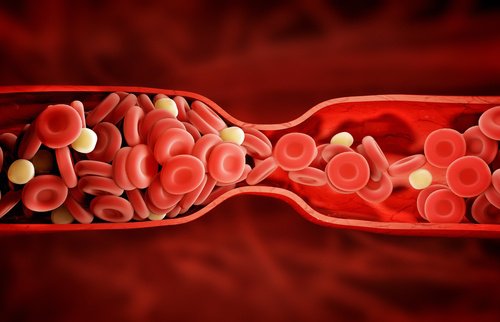 Zły cholesterol - nowa metoda leczenia!