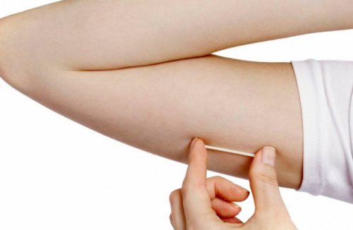 Antykoncepcja z implantem podskórnym – najczęstsze pytania