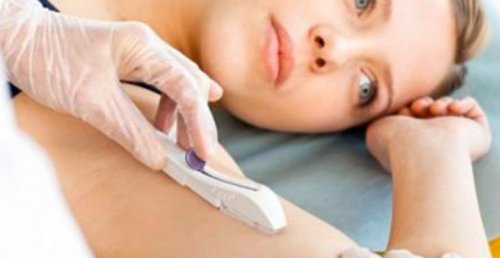 implant podskórny wszczepianie