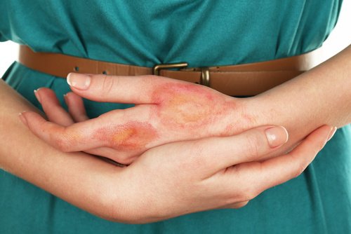 Infekcja skóry dłoni