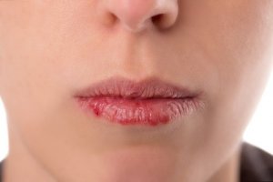 Rak jamy ustnej i gardła - groźne objawy