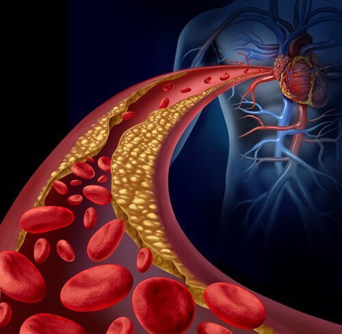 zły cholesterol