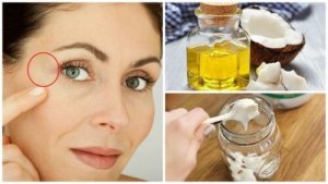 Kurze łapki - zmniejsz je za pomocą naturalnego kremu