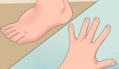 zatrzymanie wody w organizmie