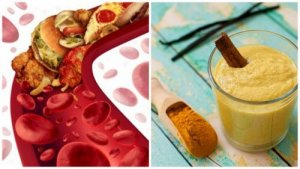 Tętnice - oczyść złogi za pomocą 5 produktów