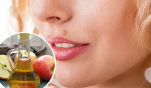 Pieprzyki - Usuń je w naturalny sposób