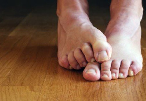 swędzące stopy - problemy z paznokciami