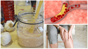 Syrop na bóle stawów i wysoki cholesterol - Przepis