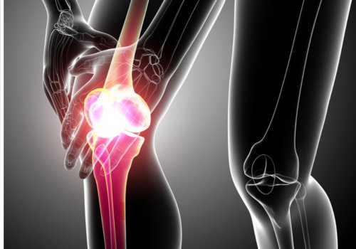 Zapalenie ścięgien w kolanie