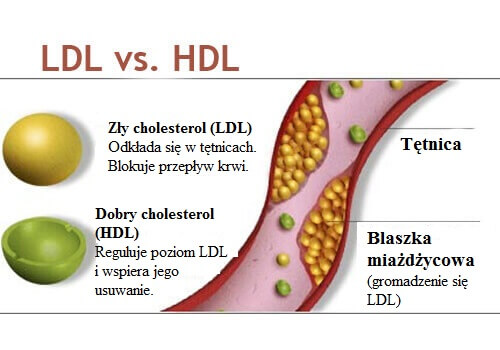 cholesterol a wątroba