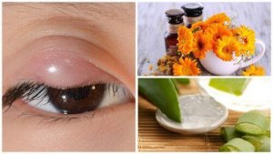 Jęczmień na oku? Wypróbuj 7 naturalnych sposobów