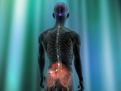 neurostymulator