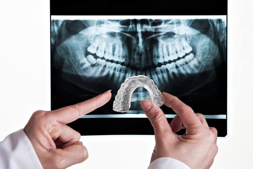 rentgen i wkładka do zębów