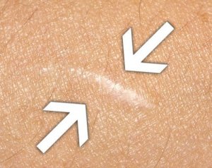 Otwarte rany? – Przyspiesz gojenie z pomocą natury