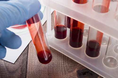 Nowotwory można wykryć wcześniej – Nowe badania krwi