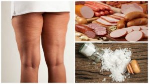 Cellulit - 7 produktów, których należy unikać, aby go zwalczyć