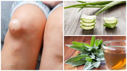 Stan zapalny kolan – 5 naturalnych remediów