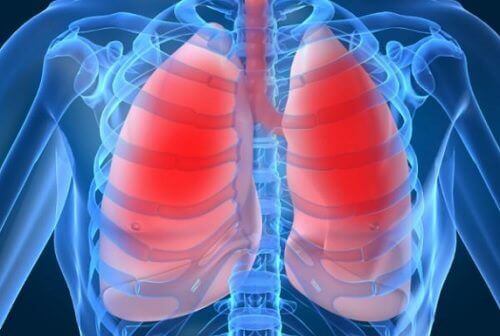 Płuca – 10 najczęstszych sygnałów ostrzegawczych