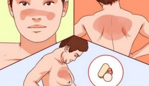 Toczeń – oto garść podstawowych informacji na temat tej choroby