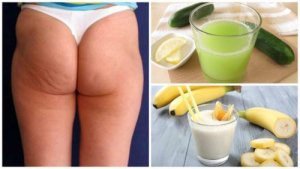 Cellulit - zmniejsz go tymi 6 naturalnymi sposobami
