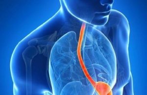 Refluks: poznaj 10 nietypowych objawów