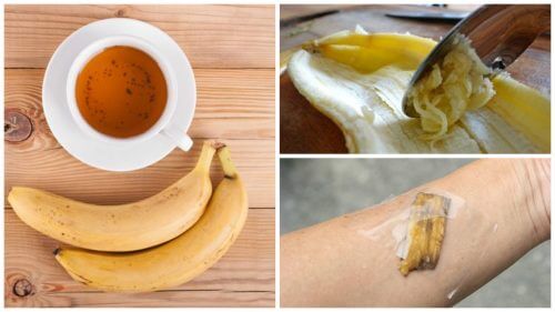 Skórka banana – 5 niecodziennych sposobów na jej wykorzystanie