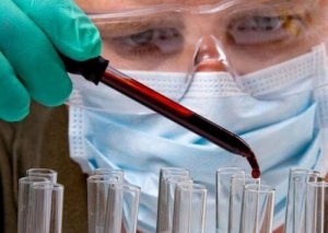 Badanie krwi - test pozwoli określić położenie guza!