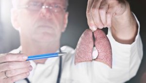 Rak płuc – Eksperymentalna terapia nadzieją dla pacjentów