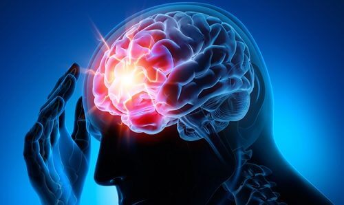 Tętniak mózgu – 7 trików pomagających w profilaktyce