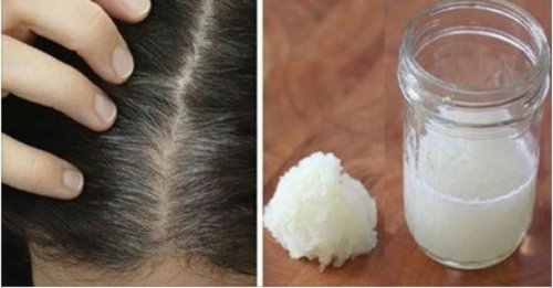 Wypadanie włosów - remedium z cebuli i miodu