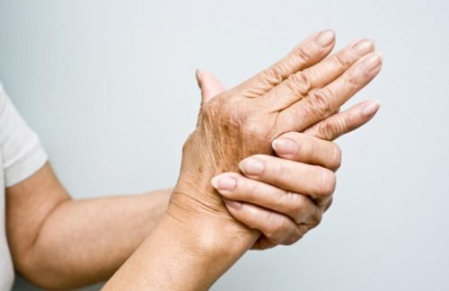 artretyzm dłonie