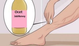 Remedium na żylaki – aloes, marchew i ocet jabłkowy