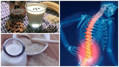 Osteoporoza - 6 najlepszych remediów naturalnych, aby jej zapobiec