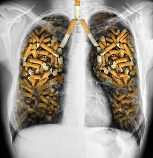 Płuca ludzkie złożone z papierosów