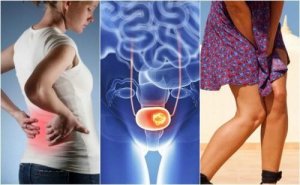 Rak pęcherza moczowego – uważaj na tych 7 objawów