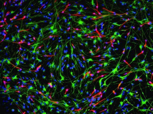 Neurony mózgowe a mózg i neurogeneza