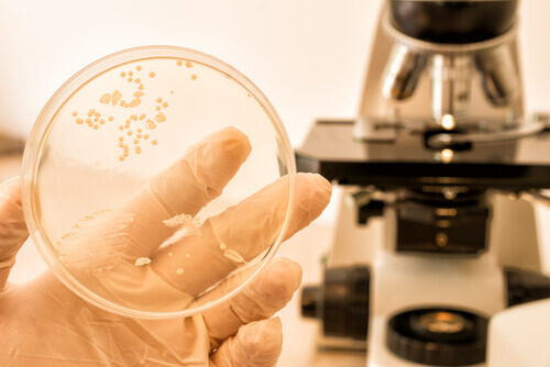 Próbka bakterii a drożdżyca