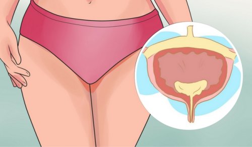 Zespół pęcherza nadreaktywnego - czego należy unikać