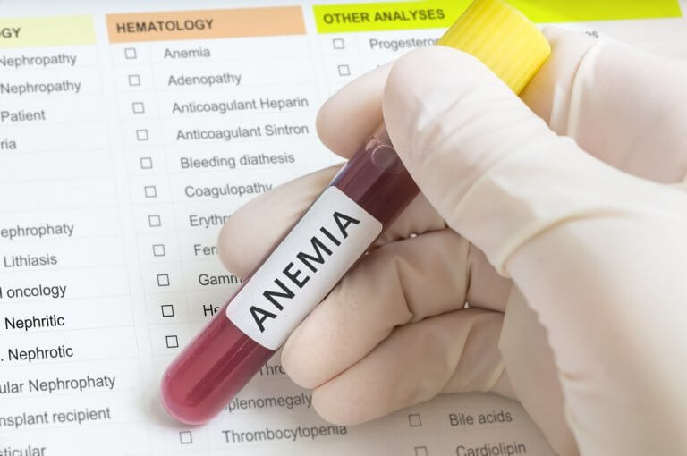 próbka krwi - anemia może, chociaż nie musi, sygnalizować problemy z nerkami