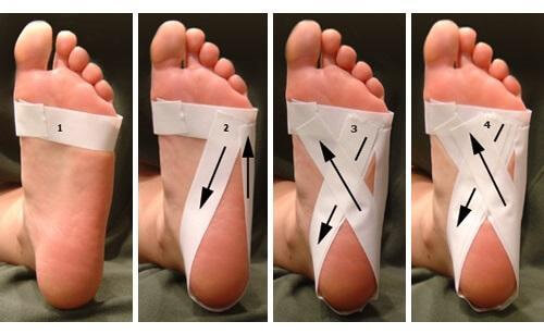 Bandaż na stopy - zespół niespokojnych nóg