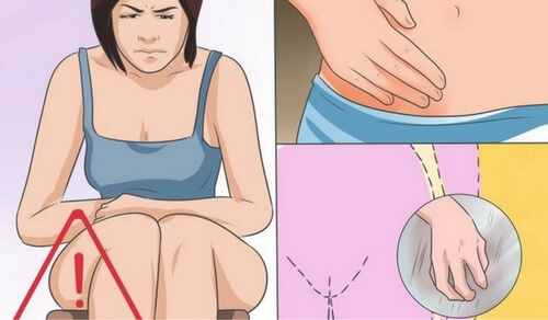 Grzybica pochwy - przyczyny, objawy i leczenie