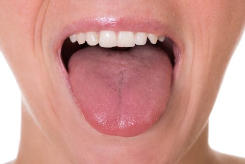 Rak języka - poznaj 5 początkowych objawów