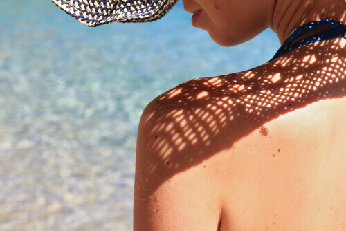 Kobieta na słońcu, obwisłe piersi a brak ochrony przeciwsłonecznej