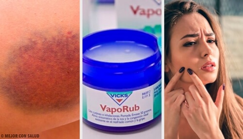 Vicks VapoRub – 11 zastosowań, o których nie miałeś pojęcia Vicks VapoRub – 11 zastosowań, o których nie miałeś pojęcia