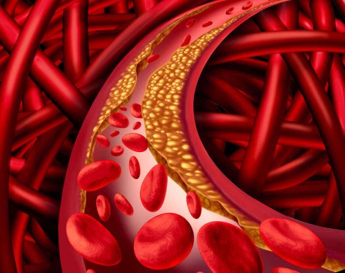 Cholesterol w tętnicach zlikwidują mandarynki