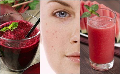 Zwalcz trądzik za pomocą 5 smoothie dodanych do diety Zwalcz trądzik za pomocą 5 smoothie dodanych do diety