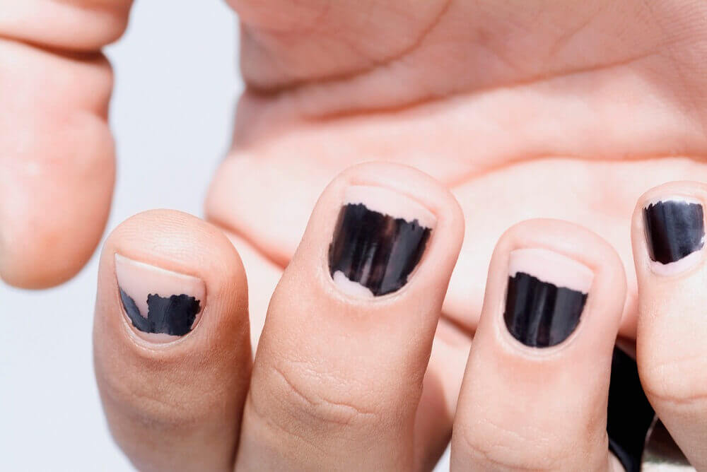 Zaniedbane paznokcie