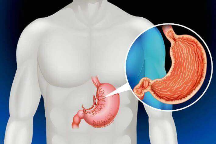 Żołądek jest jednymi z organów, których nie potrzebujesz