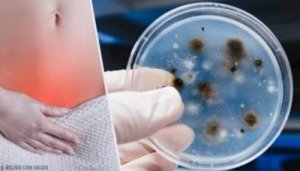 Infekcje intymne – Powszechne przyczyny i rodzaje