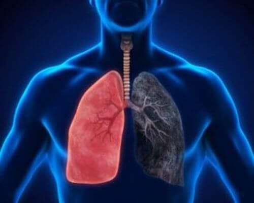 Zapalenie płuc – 8 objawów, których nie wolno ignorować